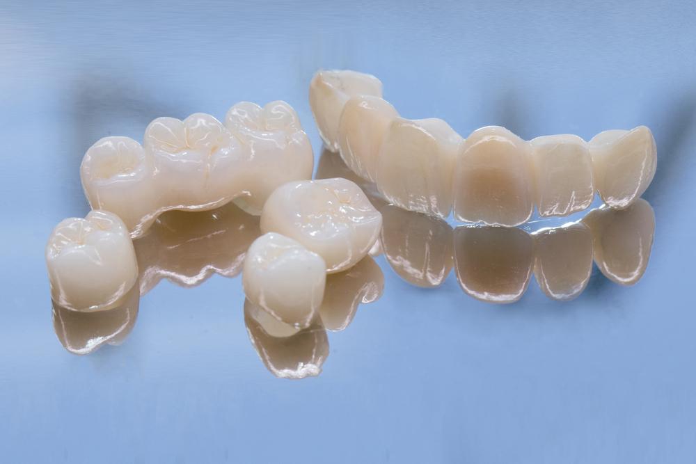 Dental Crowns in Kokomo Family Dentistry