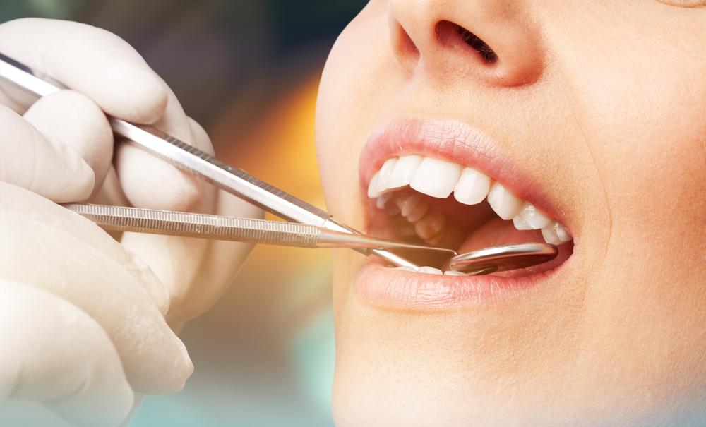 Dental Fillings Procedure in Kokomo Family Dentistry
